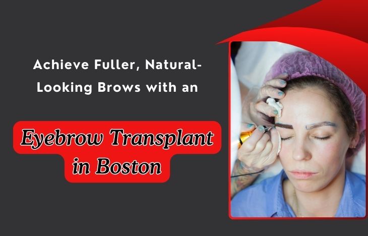 Achieve-Fuller-Natural-Looking-Brows-with-an-Eyebrow-Transplant-in-Boston